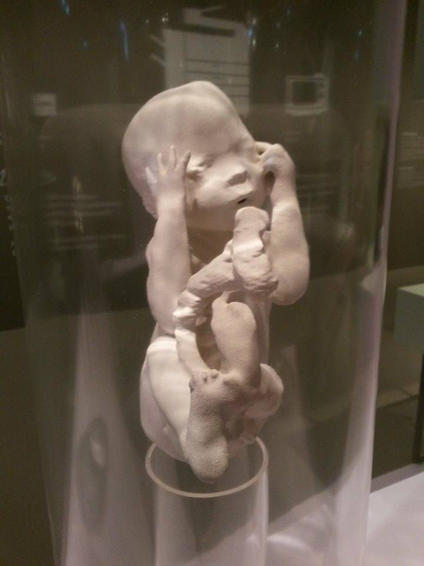 10866745_10205575584058101_1328380033_n